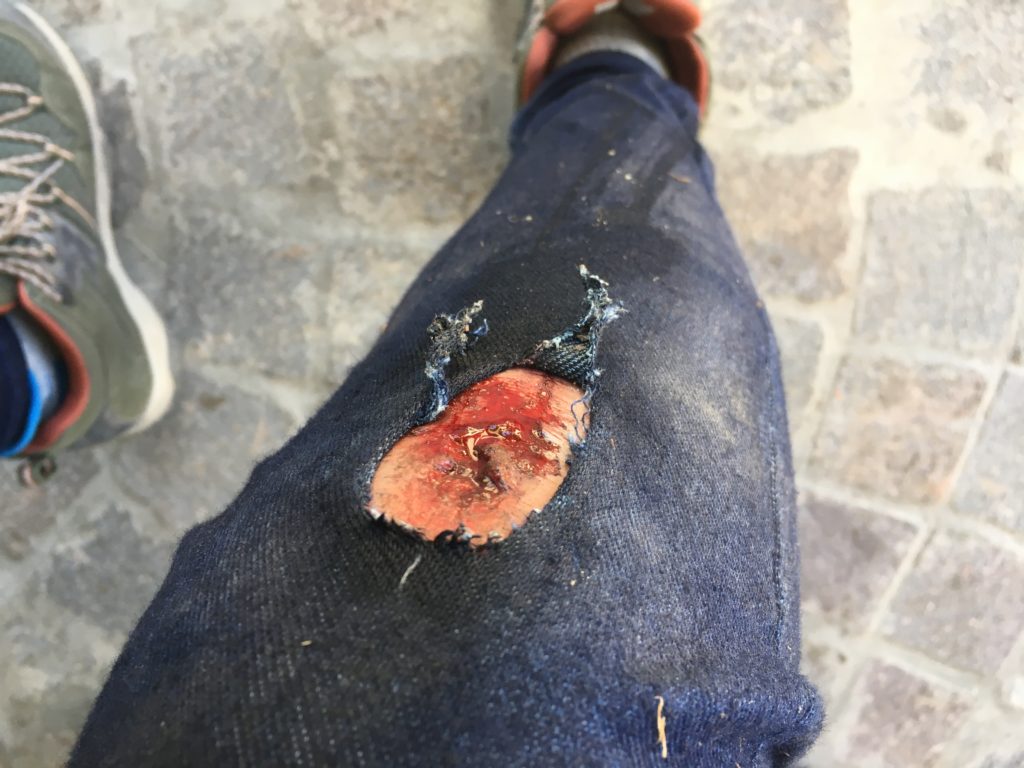 自転車事故